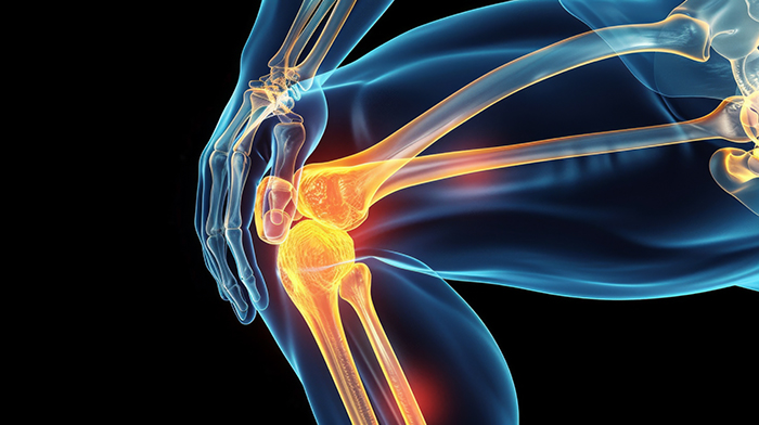 Боли в суставах - признак артрита или артроза?